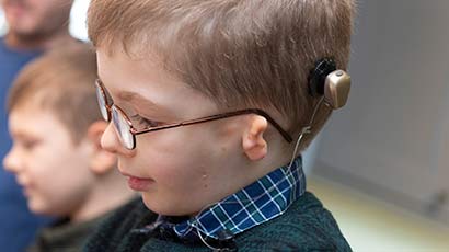 Little boy with a craniofacial condition
